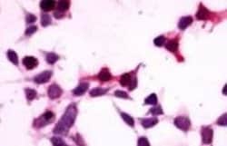 GPR27 Antibody, Novus Biologicals 50 &mu;g | Buy Online | Novus Biologicals | Fisher Scientific